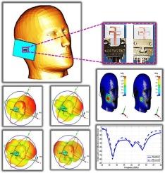 SAR assessment of miniaturized wideband MIMO antenna structure for millimeter wave 5G smartphones