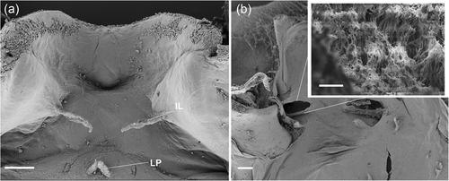 First description of buccopharyngeal anatomy in Pelodryadinae larvae: Morphological comparison and systematic implications (Anura: Hylidae: Pelodryadinae: Litoria rubella and Ranoidea caerulea)