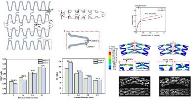 Optimized structure design of asymmetrical Mg alloy cerebrovascular stent with high flexibility