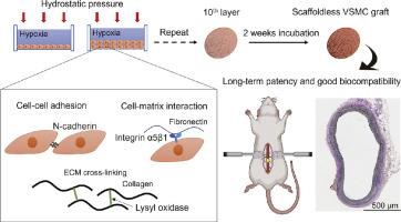 Hydrostatic pressure under hypoxia facilitates fabrication of tissue-engineered vascular grafts derived from human vascular smooth muscle cells in vitro