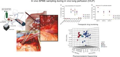 In vivo solid phase microextraction for therapeutic monitoring and pharmacometabolomic fingerprinting of lung during in vivo lung perfusion of FOLFOX