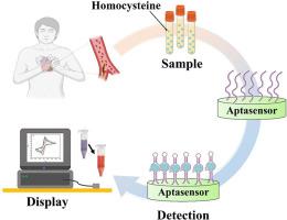 Detecting homocysteine in cardiovascular disease using aptasensors: A review