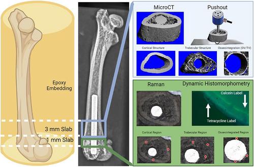 Zucker Diabetic-Sprague Dawley Rats Have Impaired Peri-Implant Bone Formation, Matrix Composition, and Implant Fixation Strength