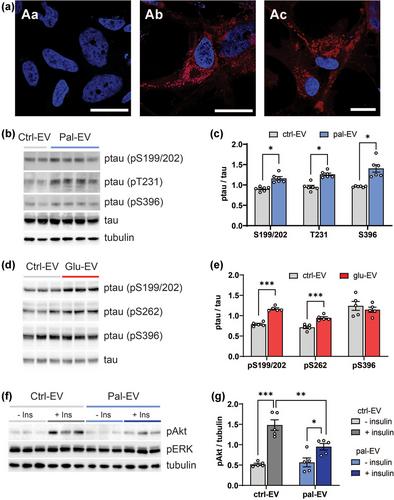 Palmitate and glucose increase amyloid precursor protein in extracellular vesicles: Missing link between metabolic syndrome and Alzheimer's disease