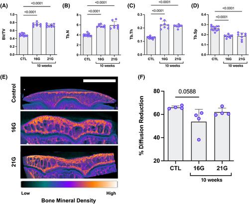 Mechanical crosstalk between the intervertebral disc, facet joints, and vertebral endplate following acute disc injury in a rabbit model