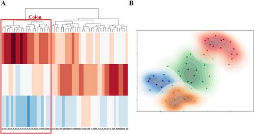 Identifying primary tumor site of origin for liver metastases via a combination of handcrafted and deep learning features