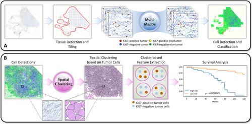 AI-based intra-tumor heterogeneity score of Ki67 expression as a prognostic marker for early-stage ER+/HER2− breast cancer