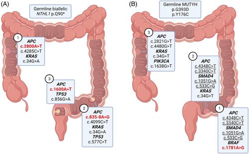 Colibactin mutational signatures in NTHL1 tumor syndrome and MUTYH associated polyposis patients