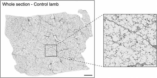 Ovine model of congenital chest wall and spine deformity: From birth to 3 months follow-up