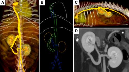 Atypical azygos continuation of the caudal vena cava in a dog