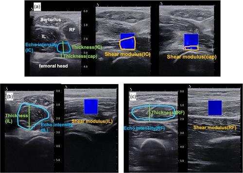 Age-related changes in muscle thickness, echo intensity and shear modulus of the iliocapsularis