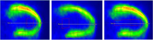 Influence of different time framings, reconstruction algorithms and post-processing methods on the quantification of myocardial blood flow from 13N-NH3 PET images