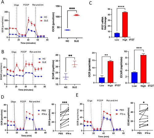 α-Ketoglutarate–Dependent KDM6 Histone Demethylases and Interferon-Stimulated Gene Expression in Lupus