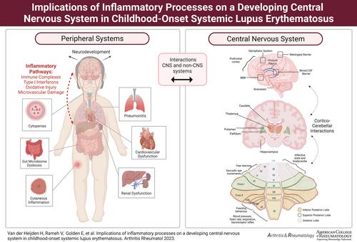 Implications of Inflammatory Processes on a Developing Central Nervous System in Childhood-Onset Systemic Lupus Erythematosus