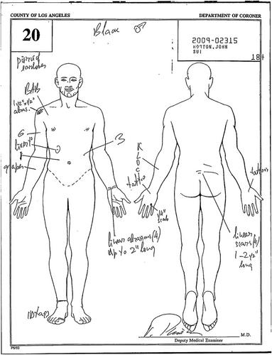 Naturalizing unnatural death in Los Angeles County jails