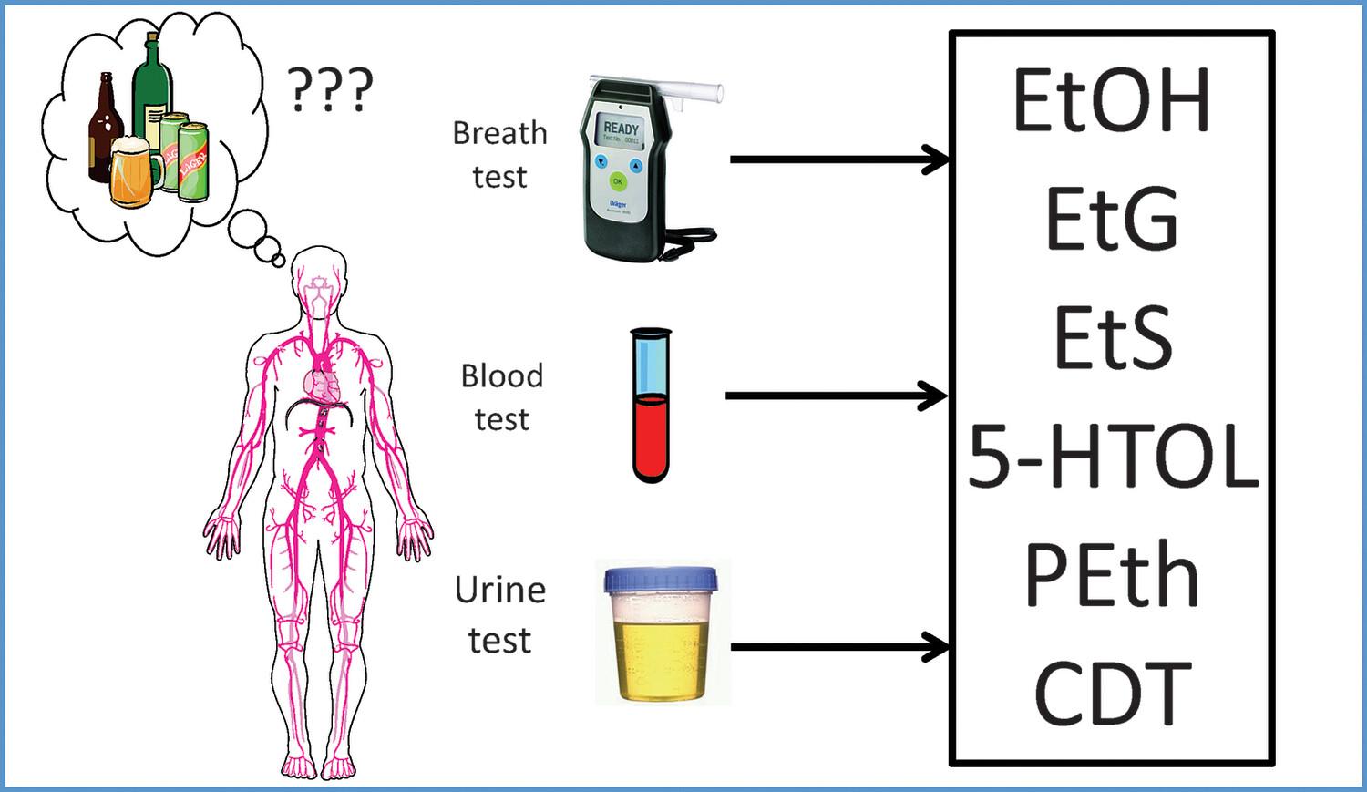 Brief history of the alcohol biomarkers CDT, EtG, EtS, 5-HTOL, and PEth