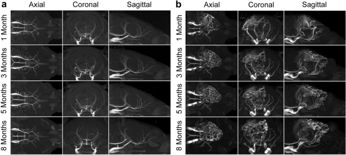 Localized conditional induction of brain arteriovenous malformations in a mouse model of hereditary hemorrhagic telangiectasia