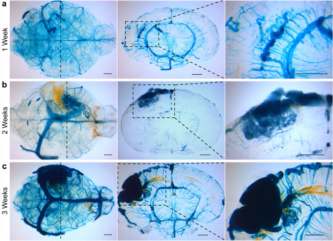 Localized conditional induction of brain arteriovenous malformations in a mouse model of hereditary hemorrhagic telangiectasia