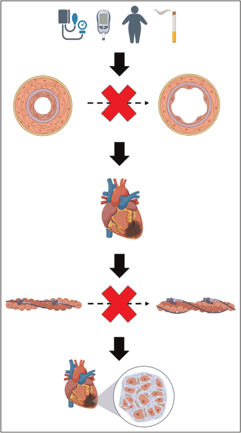 Coronary microvascular dysfunction and heart failure with preserved ejection fraction: what are the mechanistic links?