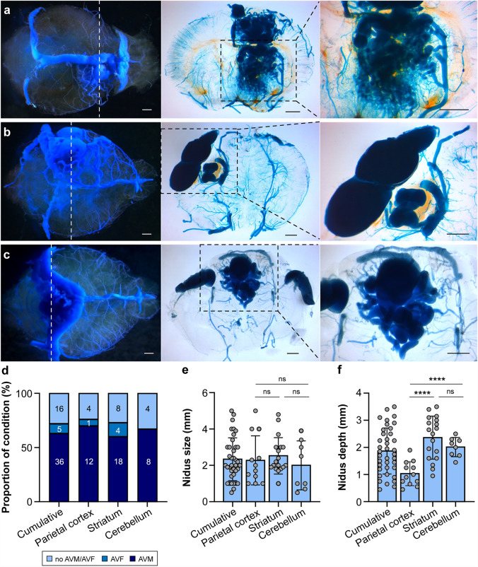 Localized conditional induction of brain arteriovenous malformations in a mouse model of hereditary hemorrhagic telangiectasia