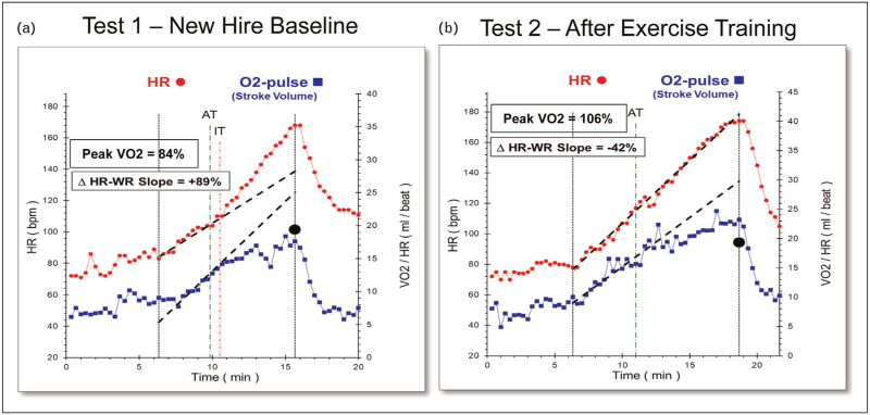 The evolving role of cardiopulmonary exercise testing in ischemic heart disease - state of the art review.