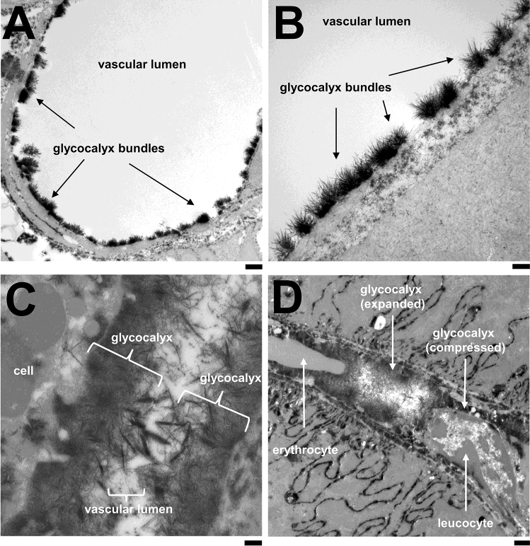 The dynamics of the endothelial glycocalyx: a rare snapshot by electron microscopy