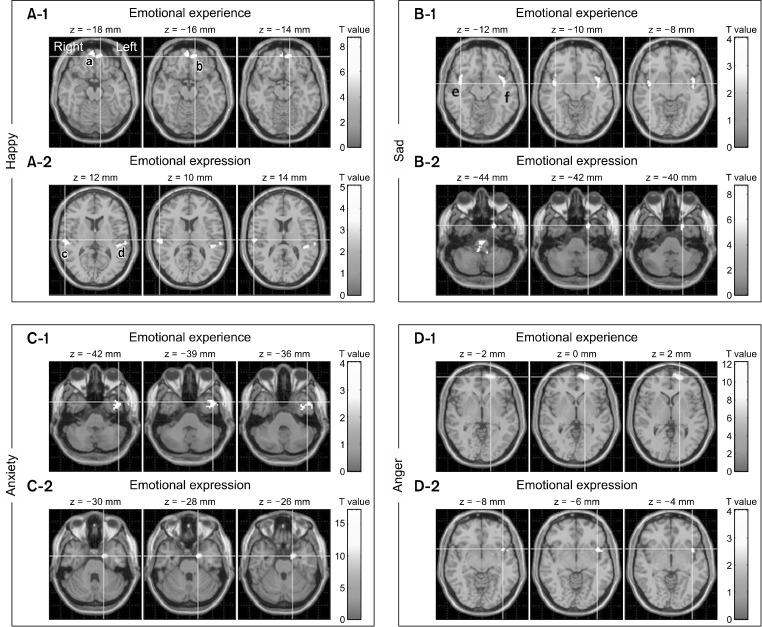 Attention Circuits Mediate the Connection between Emotional Experience and Expression within the Emotional Circuit.