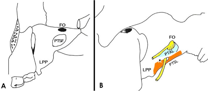 A morphological study on the sphenoid bone ligaments' ossification pattern.