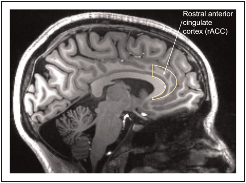 Neuropsychiatric adverse effects from CFTR modulators deserve a serious research effort.