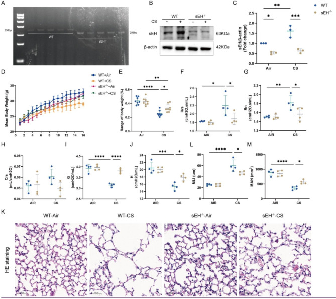 Soluble epoxide hydrolase deficiency attenuates airway inflammation in COPD via IRE1α/JNK/AP-1 signaling pathway.