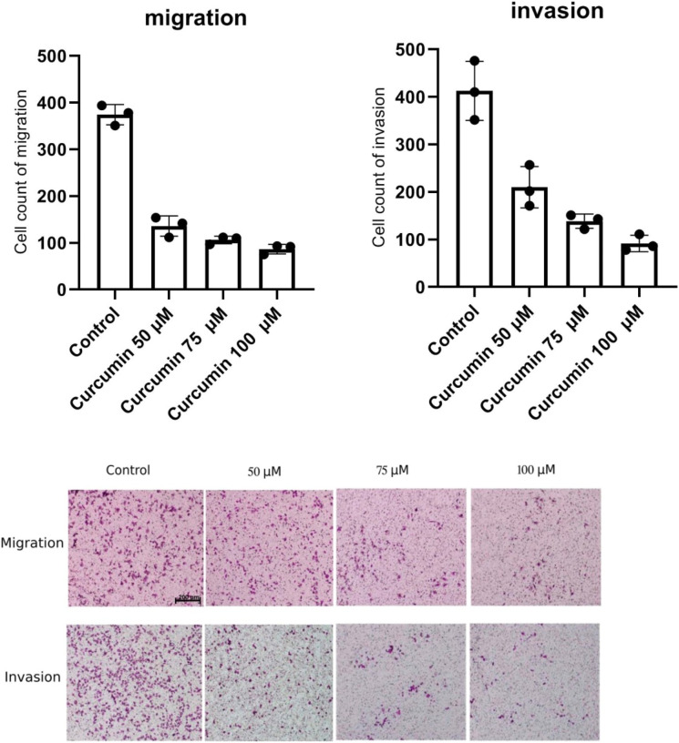 Curcumin's Dose-Dependent Attenuation of Gastric Cancer Cell Progression Via the PI3K Pathway Blockade.