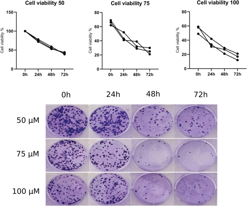 Curcumin's Dose-Dependent Attenuation of Gastric Cancer Cell Progression Via the PI3K Pathway Blockade.