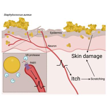 S. aureus drives itch and scratch-induced skin damage through a V8 protease-PAR1 axis