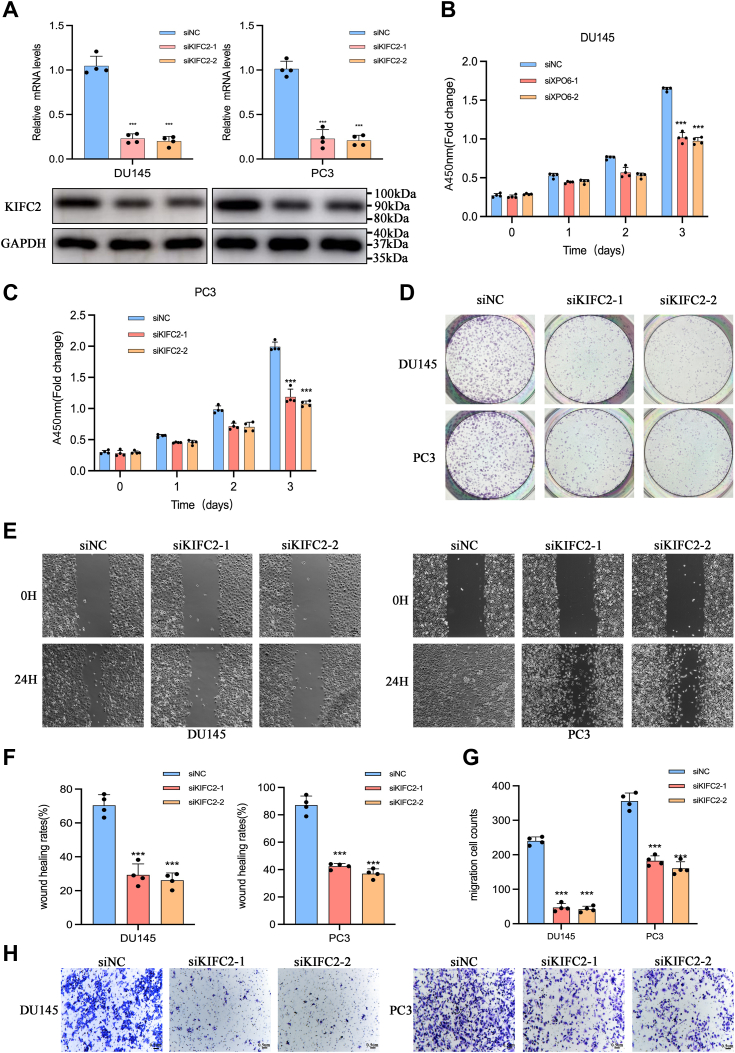 The kinesin-14 family motor protein KIFC2 promotes prostate cancer progression by regulating p65.