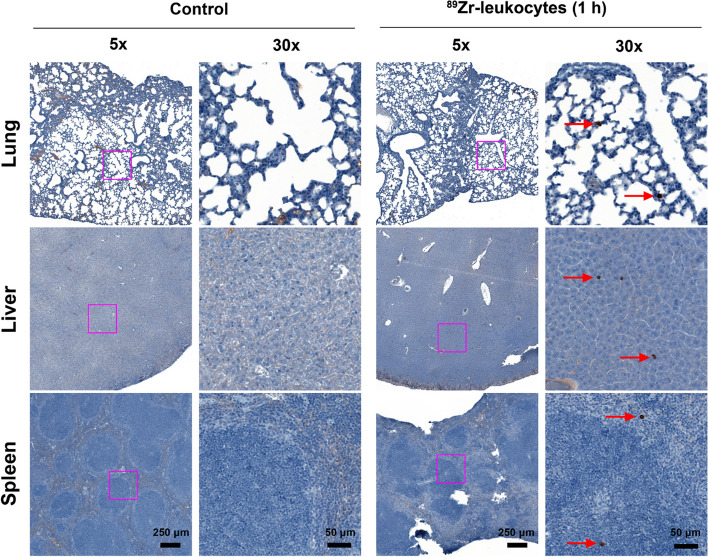 89Zr-leukocyte labelling for cell trafficking: in vitro and preclinical investigations