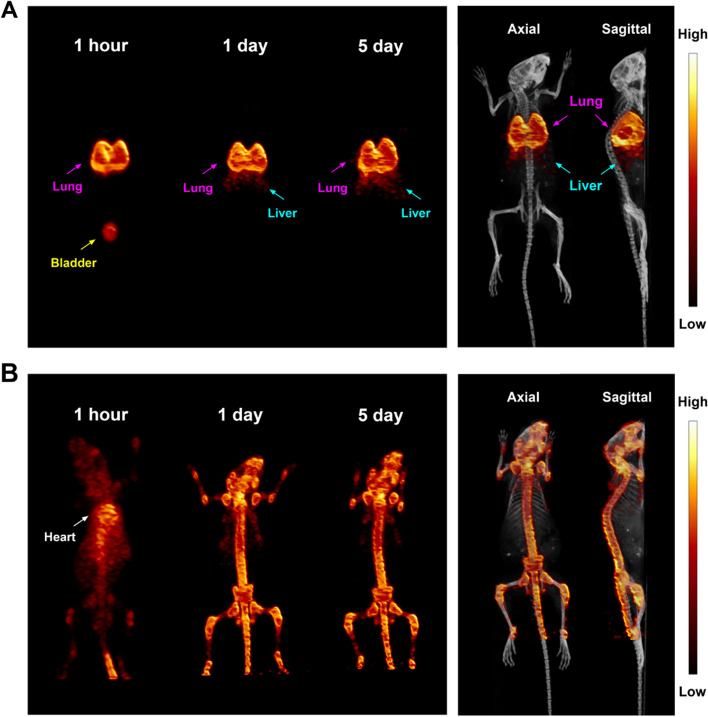 89Zr-leukocyte labelling for cell trafficking: in vitro and preclinical investigations