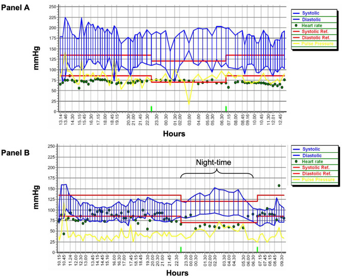 Does Renal Denervation a Reasonable Treatment Option in Hemodialysis-Dependent Patient with Resistant Hypertension? A Narrative Review.