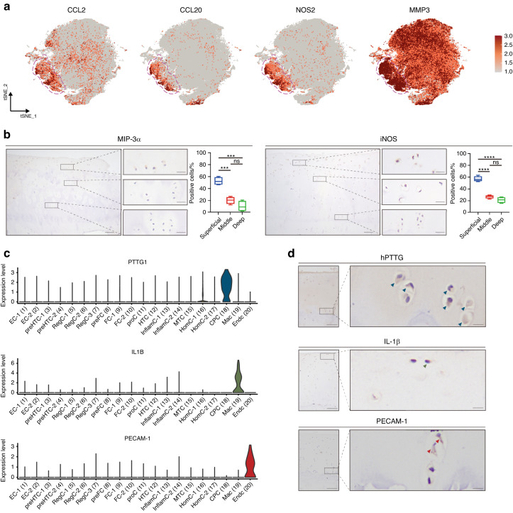 Combining single-cell RNA sequencing and population-based studies reveals hand osteoarthritis-associated chondrocyte subpopulations and pathways.