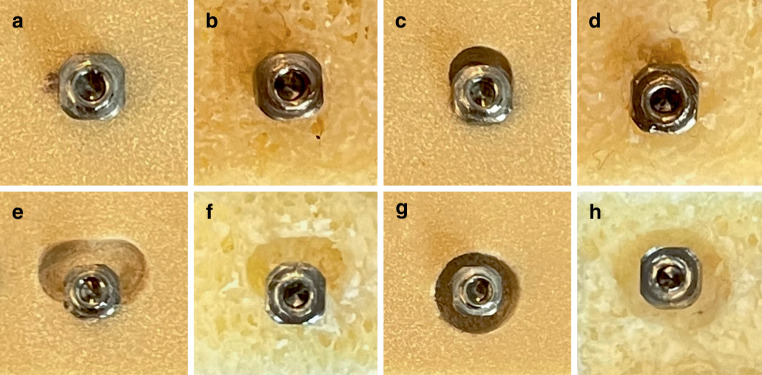 Significance of bone morphology and quality on the primary stability of orthodontic mini-implants: in vitro comparison between human bone substitute and artificial bone.