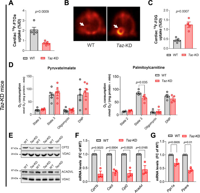 Activation of the integrated stress response rewires cardiac metabolism in Barth syndrome.