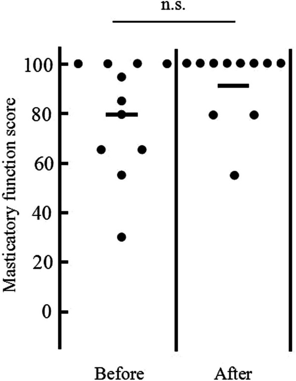 Measures of oral health-related quality of life in patients with bone graft and implant prosthetic rehabilitation at the anterior of mandible/maxilla among young and middle-aged adults: a retrospective pilot study.