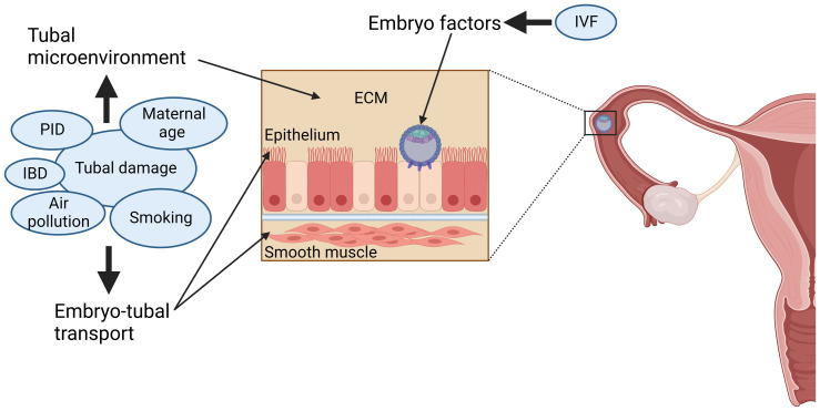 Recent advances in the understanding of tubal ectopic pregnancy.