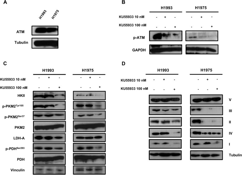 ATM inhibition blocks glucose metabolism and amplifies the sensitivity of resistant lung cancer cell lines to oncogene driver inhibitors.