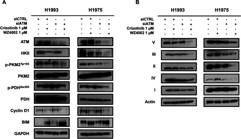 ATM inhibition blocks glucose metabolism and amplifies the sensitivity of resistant lung cancer cell lines to oncogene driver inhibitors.