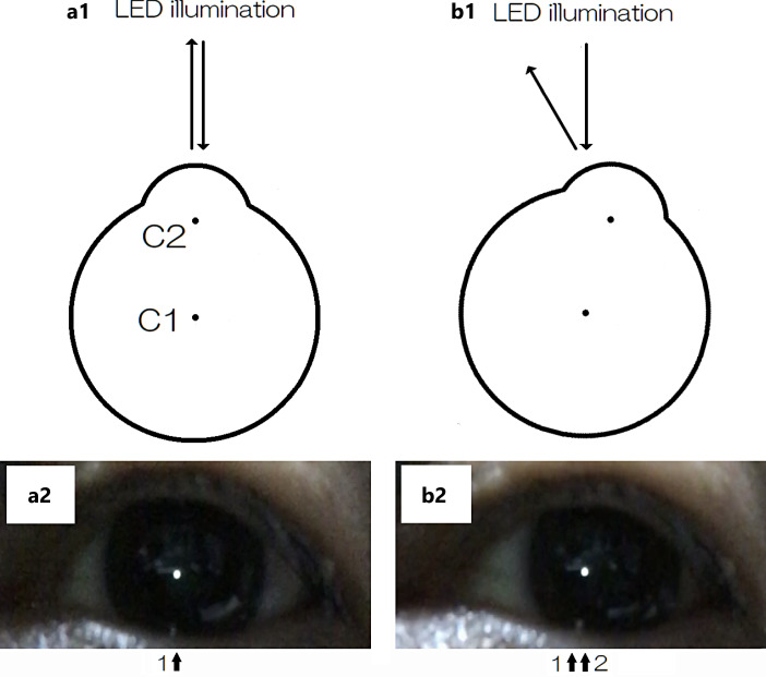 Development of a Prototype Video Head Impulse Test System Using an iPhone for Screening of Peripheral Vestibular Dysfunction.