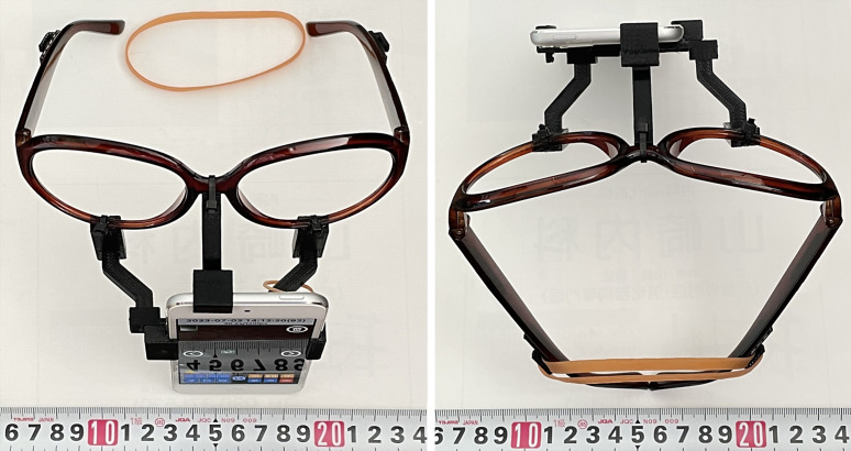 Development of a Prototype Video Head Impulse Test System Using an iPhone for Screening of Peripheral Vestibular Dysfunction.