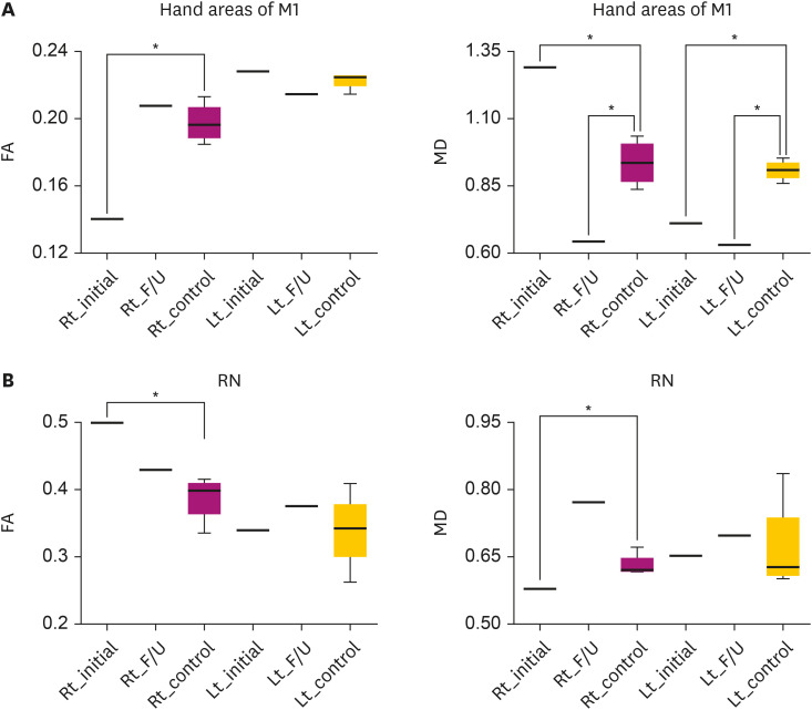 Compensatory Hyperactivity of the Ipsilesional Red Nucleus in a Patient With Somatosensory Cortex Damage: A Case Report.