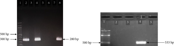 Ready-to-Eat Foods: A Potential Vehicle for the Spread of Coagulase-Positive Staphylococci and Antimicrobial-Resistant <i>Staphylococcus aureus</i> in Buea Municipality, South West Cameroon.