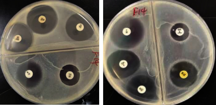 Ready-to-Eat Foods: A Potential Vehicle for the Spread of Coagulase-Positive Staphylococci and Antimicrobial-Resistant <i>Staphylococcus aureus</i> in Buea Municipality, South West Cameroon.