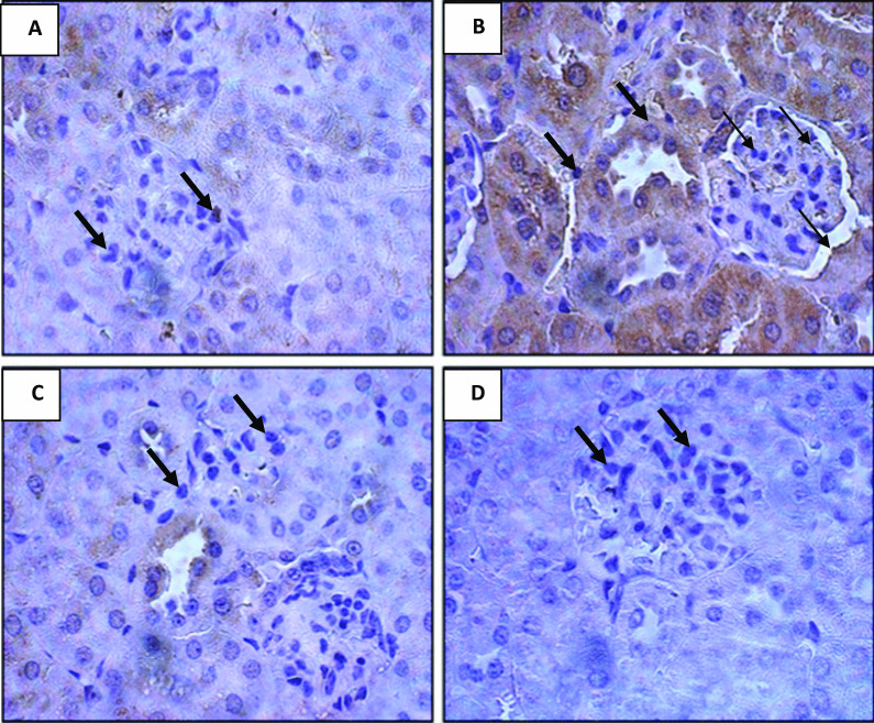 Shikimic acid recovers diarrhea and its complications in SD rats fed lactose diet to induce diarrhea.